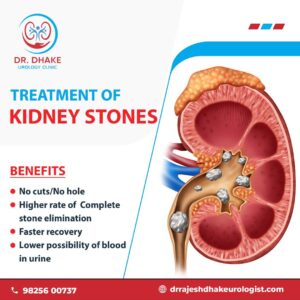 Dr. Rajesh Dhake, Urologist in Pune, Kidney Stone Specialist in Pune , Urologist in Dange Chowk , Kalewadi, Pimpri, Pune, PCMC.