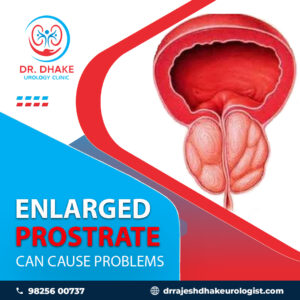 Dr. Rajesh Dhake, Urologist in Pune, Kidney Stone Specialist in Pune , Urologist in Dange Chowk , Kalewadi, Pimpri, Pune, PCMC.