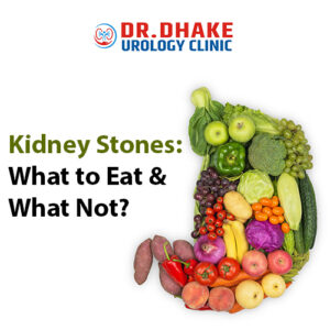 Kidney Stones: What to Eat & What Not?