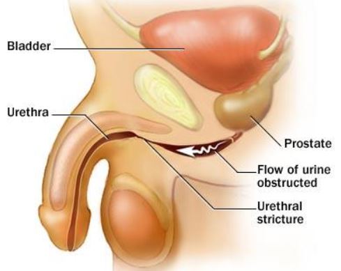 Urethral-Stricture-Male-reproductive-organ-location-anatomy