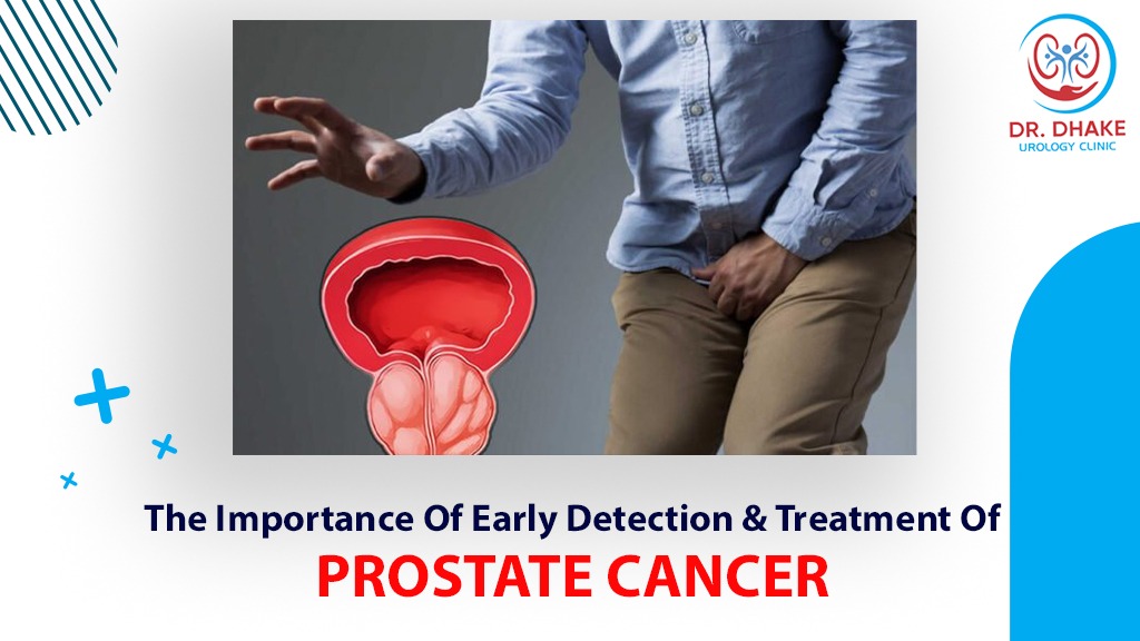 The Importance of Early Detection and Treatment of Prostate Cancer