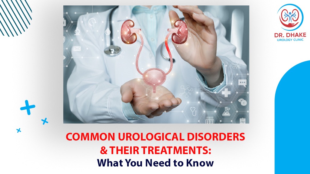 Kidney Pain or Renal Colic - Causes and Treatment - Best Urologist in  Manhattan - Treatment of Urological Pain Syndromes