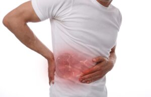 Common Causes of Kidney Stones and How to Prevent Them