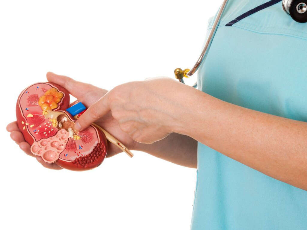 Recognizing the Symptoms of Kidney Stones- When to Seek Medical Help