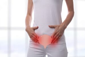 UTIs in Women- Exploring Gender: Specific Risk Factors and Treatment Approaches