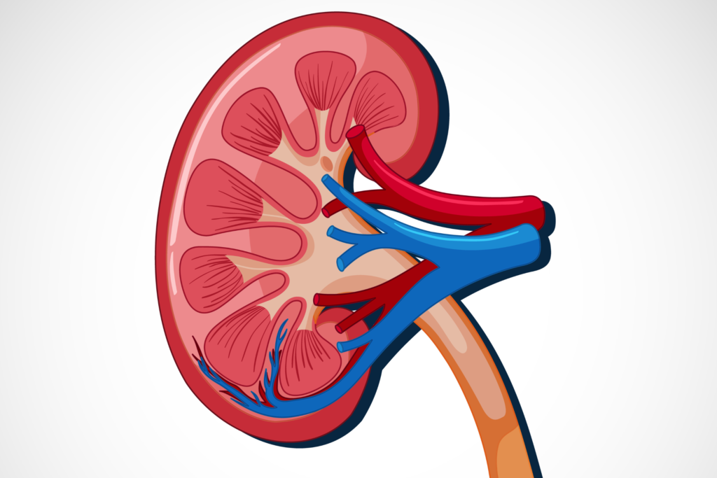 The Benefits of Laser Treatment for Kidney Stones