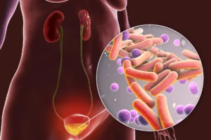 Managing Urinary Problems: How Expert Urology Services Make a Difference